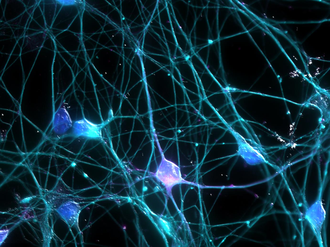 Cultured neuronal Network